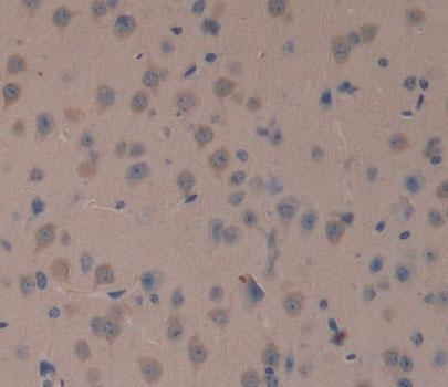 Polyclonal Antibody to Topoisomerase I, Mitochondrial (TOP1MT)