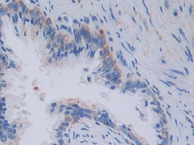 Polyclonal Antibody to Topoisomerase III (TOP3)