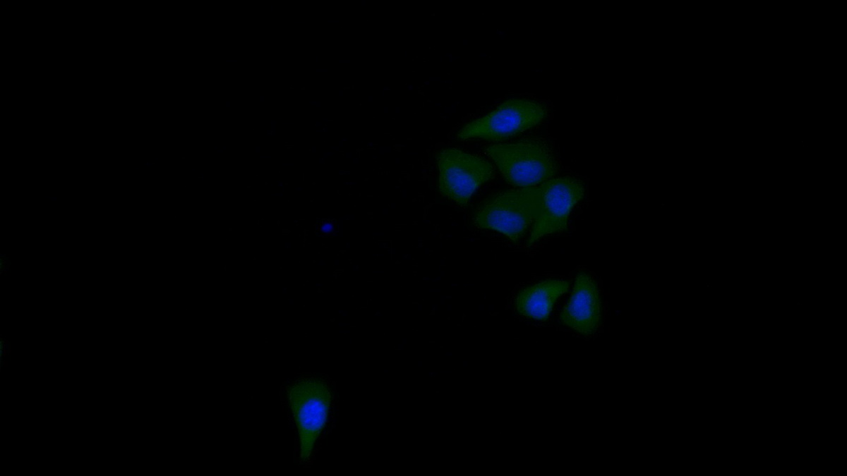 Polyclonal Antibody to Topoisomerase II Binding Protein 1 (TOPBP1)