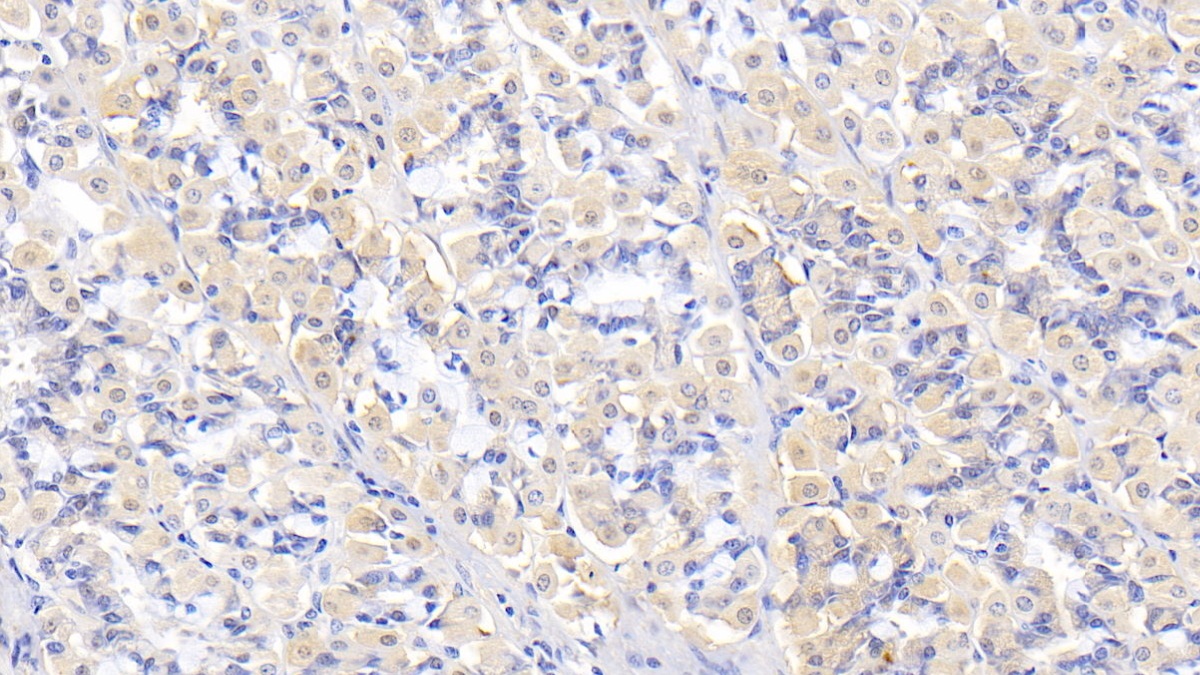 Polyclonal Antibody to Thrombospondin 2 (THBS2)