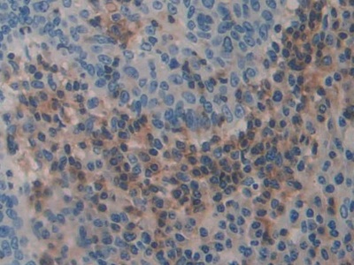 Polyclonal Antibody to Thrombospondin 3 (THBS3)