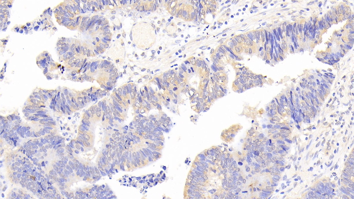 Polyclonal Antibody to Phospholipase A2, Group III (PLA2G3)