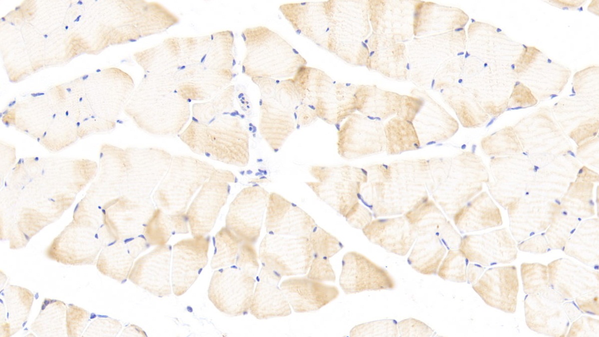 Polyclonal Antibody to Phospholipase A2, Group XII (PLA2G12)