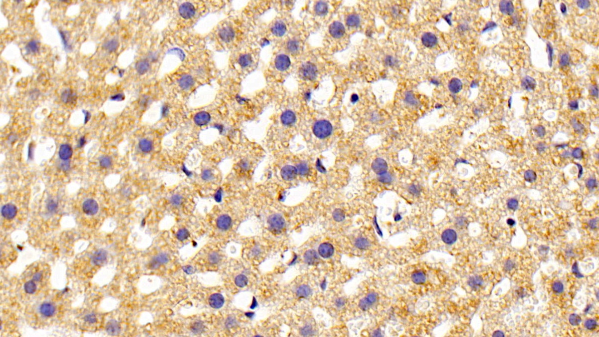 Polyclonal Antibody to Phospholipase C Epsilon 1 (PLCe1)