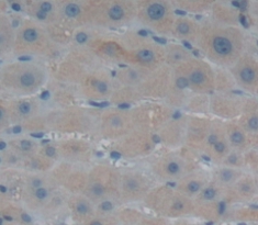 Polyclonal Antibody to Alanine Aminotransferase 2 (ALT2)