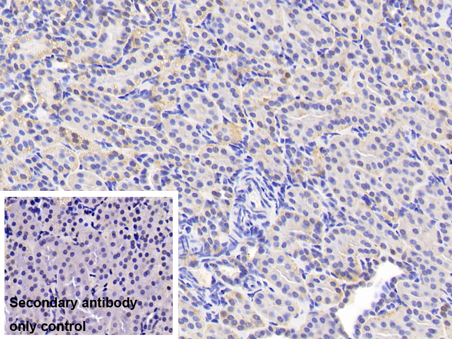 Polyclonal Antibody to Alanine Glyoxylate Aminotransferase 2 (AGXT2)