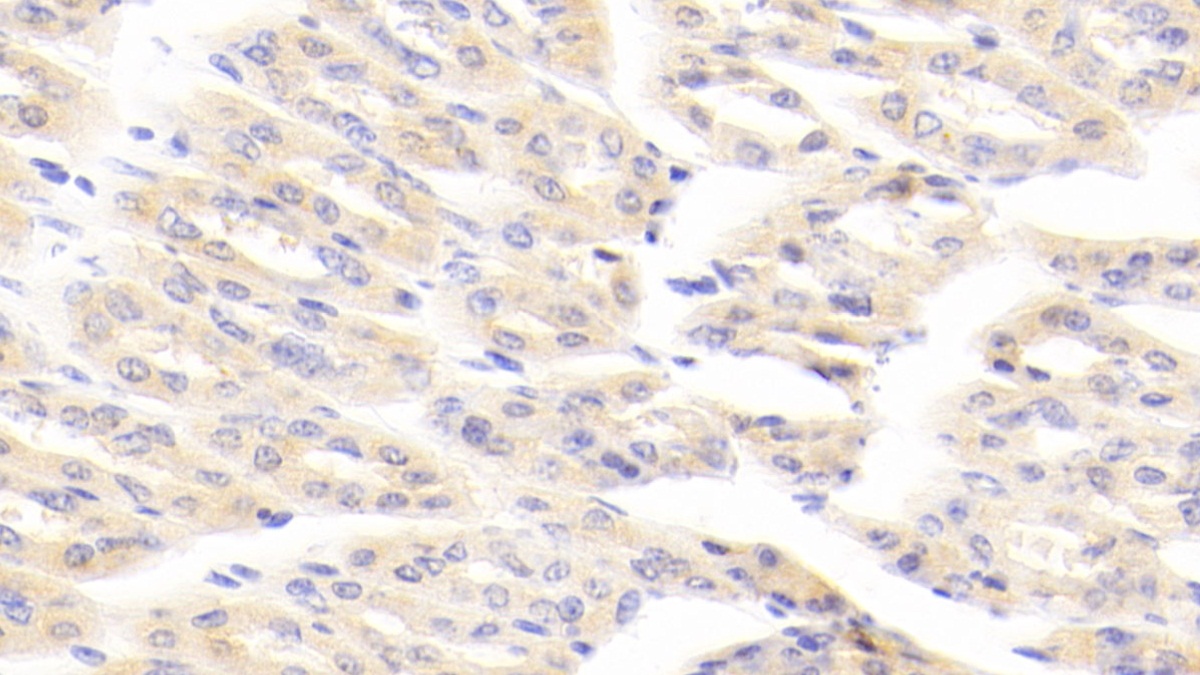 Polyclonal Antibody to Aminoadipate Aminotransferase (AADAT)