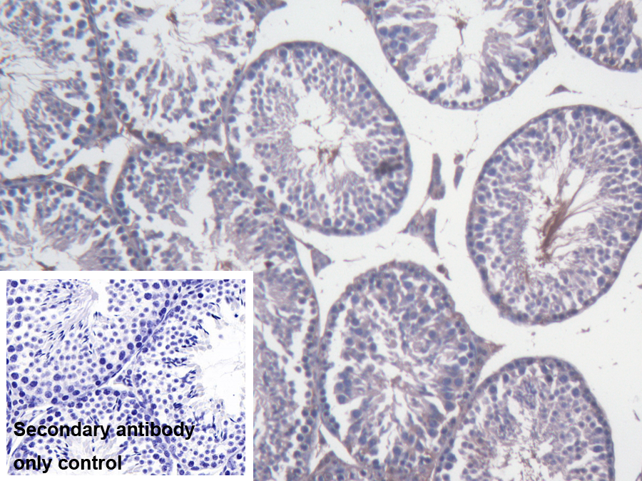 Polyclonal Antibody to Branched Chain Aminotransferase 1, Cytosolic (BCAT1)