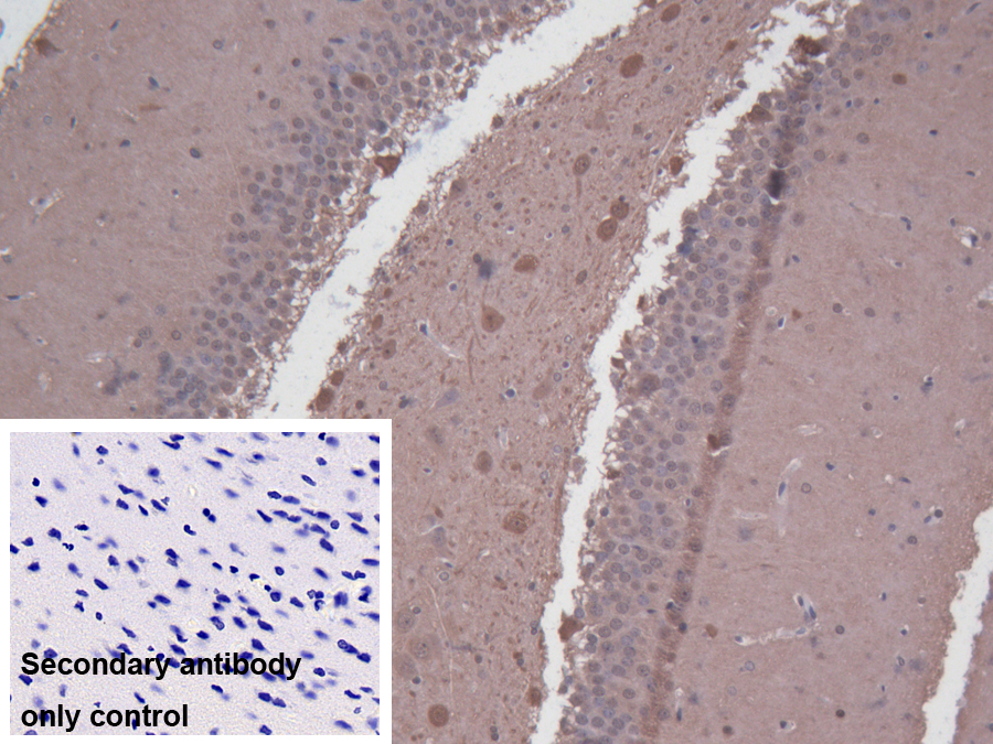 Polyclonal Antibody to Branched Chain Aminotransferase 1, Cytosolic (BCAT1)