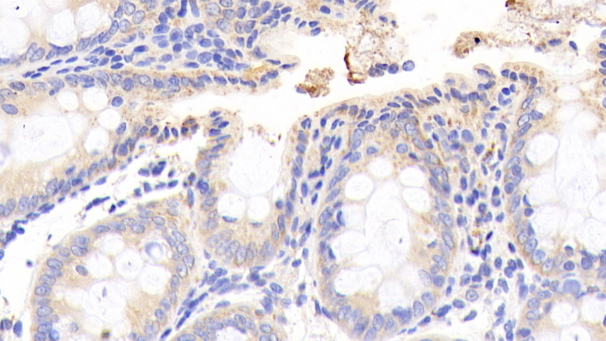 Polyclonal Antibody to Branched Chain Aminotransferase 2, Mitochondrial (BCAT2)