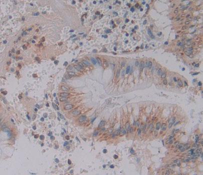 Polyclonal Antibody to Glutamine Fructose-6-Phosphate Transaminase 2 (GFPT2)