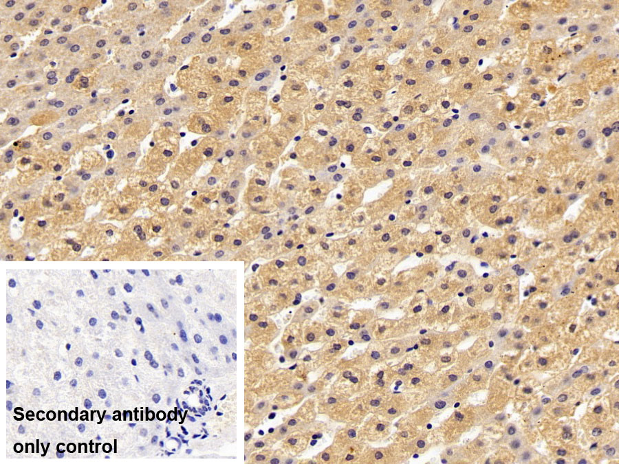 Polyclonal Antibody to Insulin Like Growth Factor Binding Protein, Acid Labile Subunit (IGFALS)