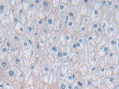 Polyclonal Antibody to Dipeptidyl Peptidase 7 (DPP7)