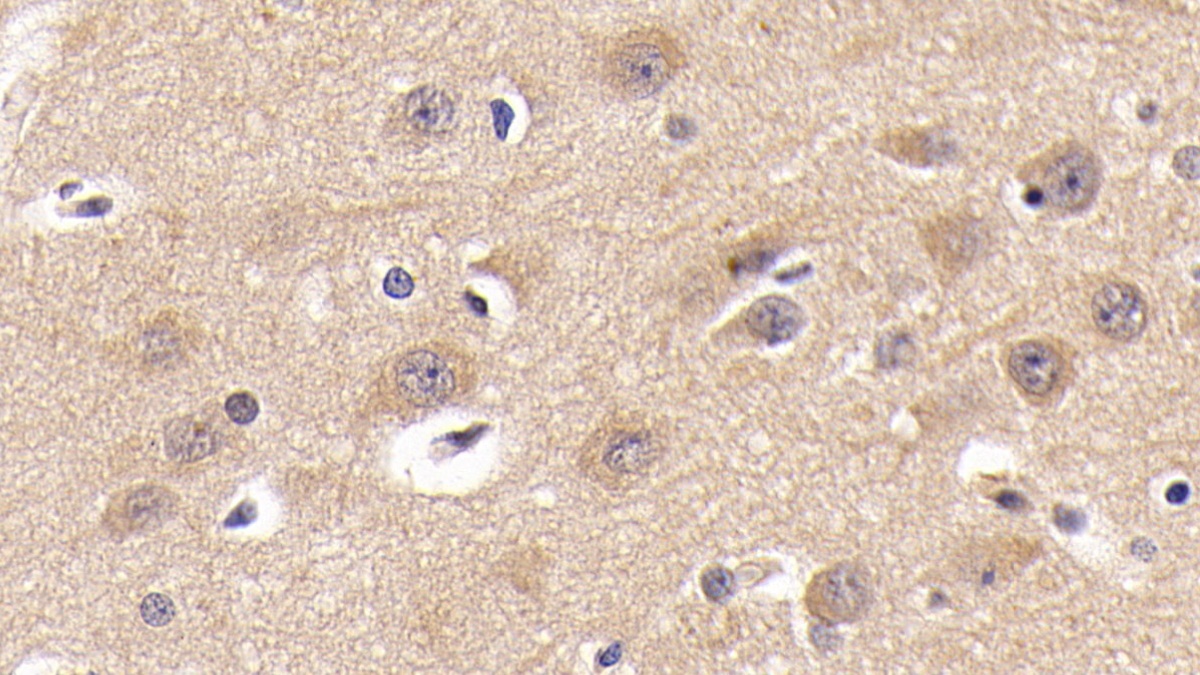 Polyclonal Antibody to Tumor Necrosis Factor Receptor Superfamily, Member 21 (TNFRSF21)