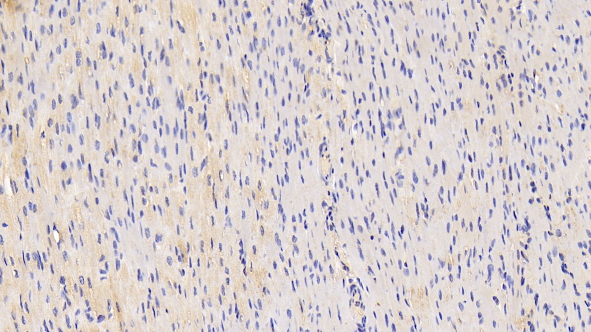 Polyclonal Antibody to Tumor Necrosis Factor Ligand Superfamily, Member 12 (TNFSF12)