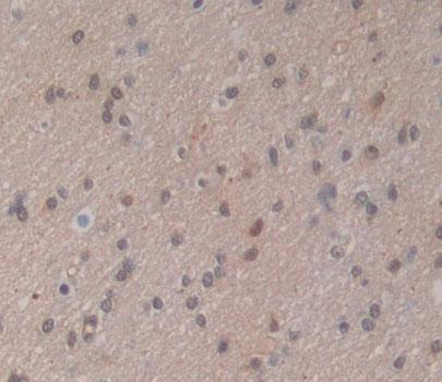 Polyclonal Antibody to Proteasome Assembly Chaperone 2 (PSMG2)