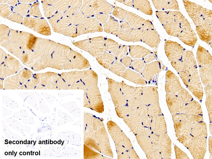 Polyclonal Antibody to 5',3'-Nucleotidase, Cytosolic (NT5C)