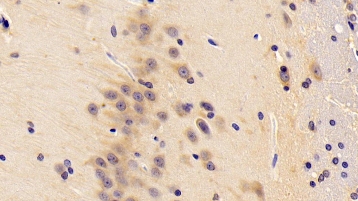 Polyclonal Antibody to 5'-Nucleotidase, Mitochondrial (NT5M)