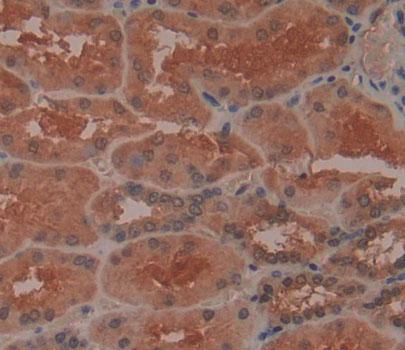 Polyclonal Antibody to 3',5'-Bisphosphate Nucleotidase 1 (BPNT1)