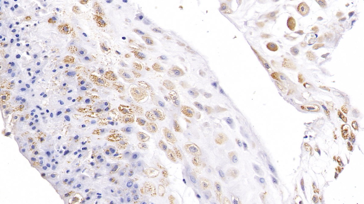 Polyclonal Antibody to 5'-Nucleotidase, Cytosolic II (NT5C2)