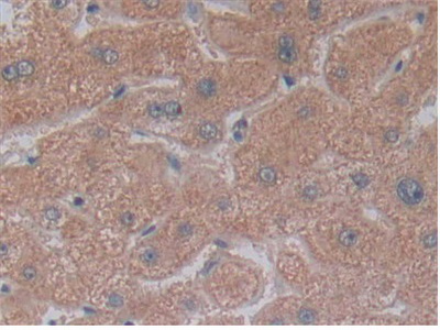 Polyclonal Antibody to 5'-Nucleotidase, Cytosolic III (NT5C3)