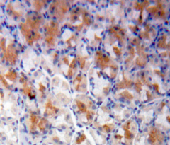 Polyclonal Antibody to 5'-Nucleotidase, Cytosolic III (NT5C3)