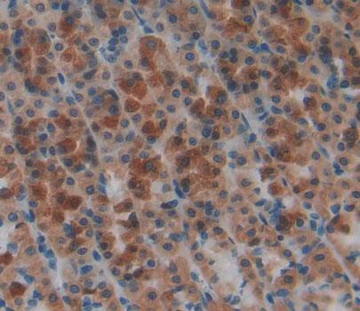 Polyclonal Antibody to 5'-Nucleotidase, Cytosolic III (NT5C3)