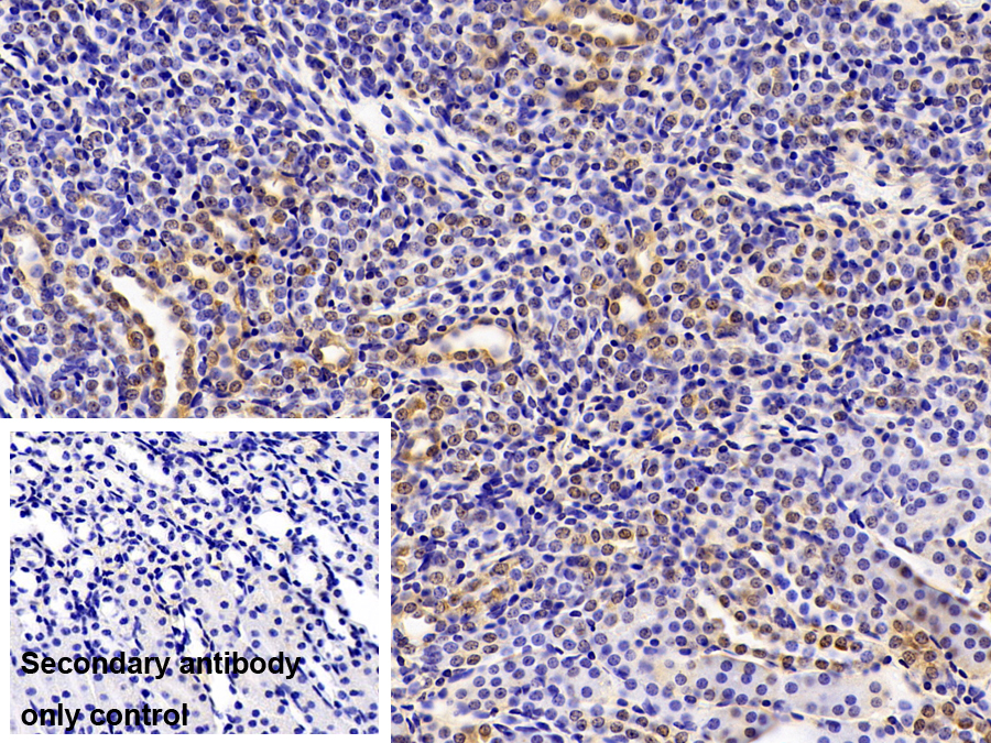 Polyclonal Antibody to Pregnane X Receptor (PXR)