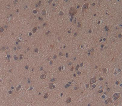 Polyclonal Antibody to Testicular Receptor 2 (TR2)