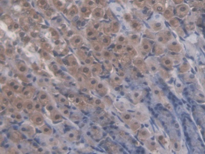 Polyclonal Antibody to Liver Receptor Homolog 1 (LRH1)