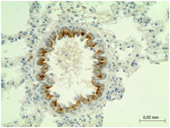 Polyclonal Antibody to Adrenergic Receptor Beta 2 (ADRb2)