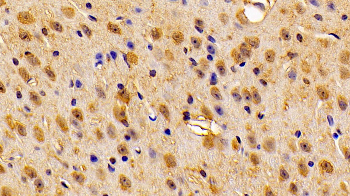 Polyclonal Antibody to Calcyon Neuron Specific Vesicular Protein (CALY)