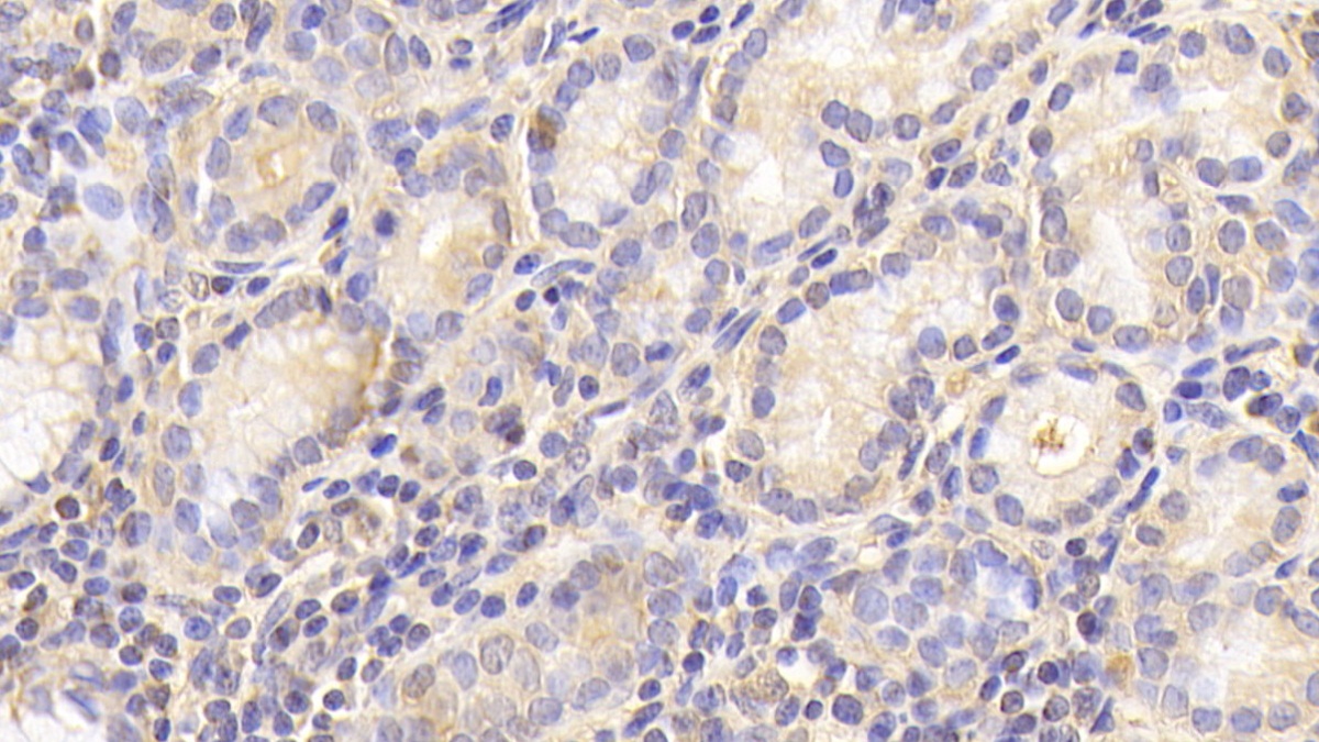 Polyclonal Antibody to Cathepsin O (CTSO)