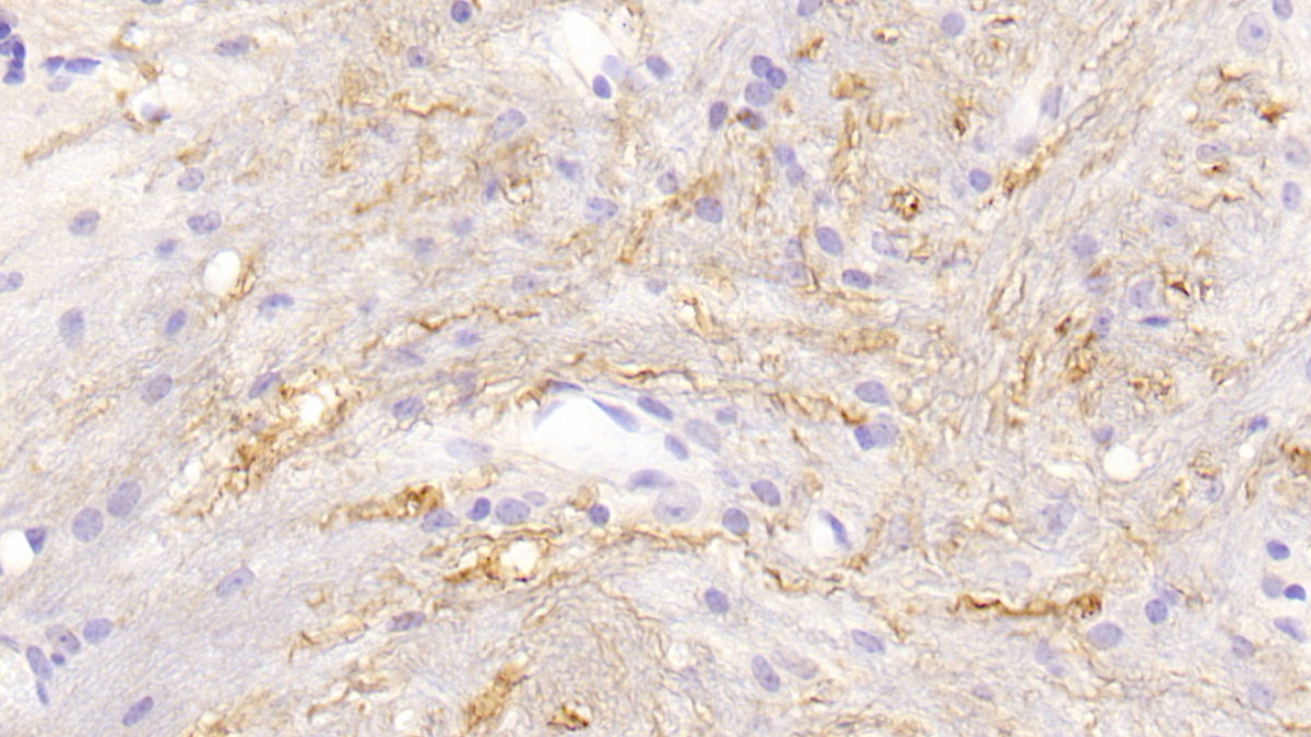 Polyclonal Antibody to Cathepsin G (CTSG)