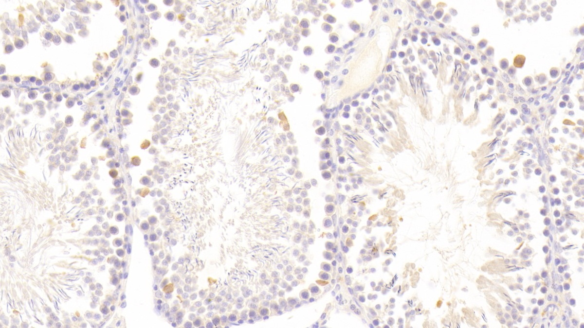 Polyclonal Antibody to Glutathione Peroxidase 5 (GPX5)