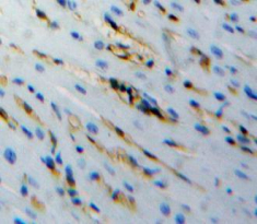 Polyclonal Antibody to Procollagen C Proteinase Enhancer 2 (PCPE2)