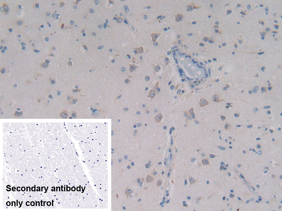 Polyclonal Antibody to Procollagen C Proteinase Enhancer 2 (PCPE2)