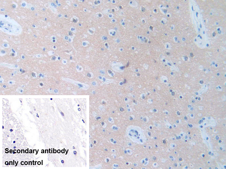 Polyclonal Antibody to Protein Phosphatase 3, Regulatory Subunit 1 (PPP3R1)