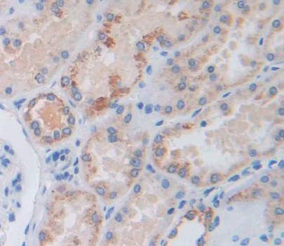 Polyclonal Antibody to Calcineurin Like Phosphoesterase Domain Containing Protein 1 (CPPED1)