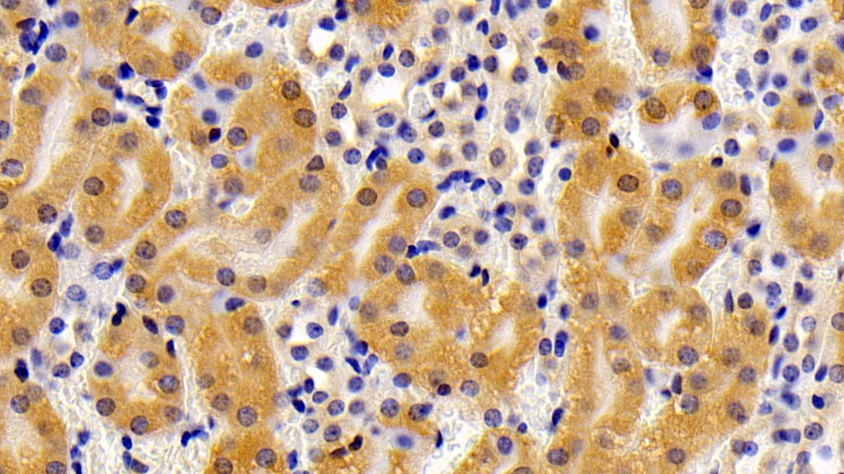 Polyclonal Antibody to Calcineurin Like Phosphoesterase Domain Containing Protein 1 (CPPED1)