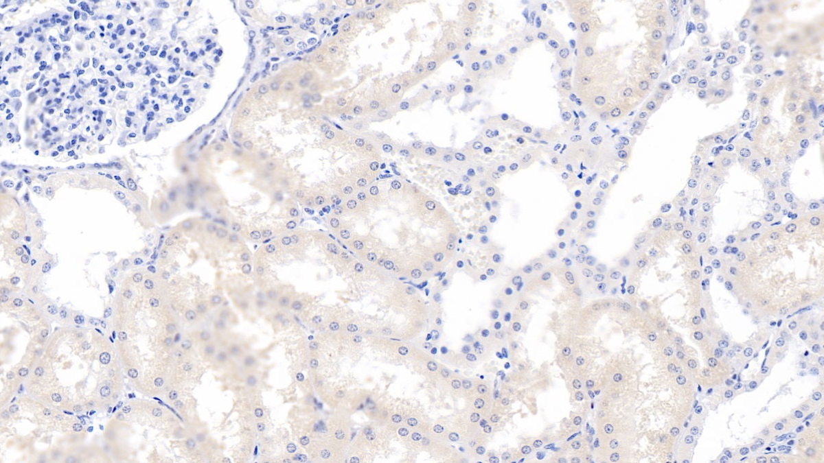 Polyclonal Antibody to Neurofilament, Light Polypeptide (NEFL)