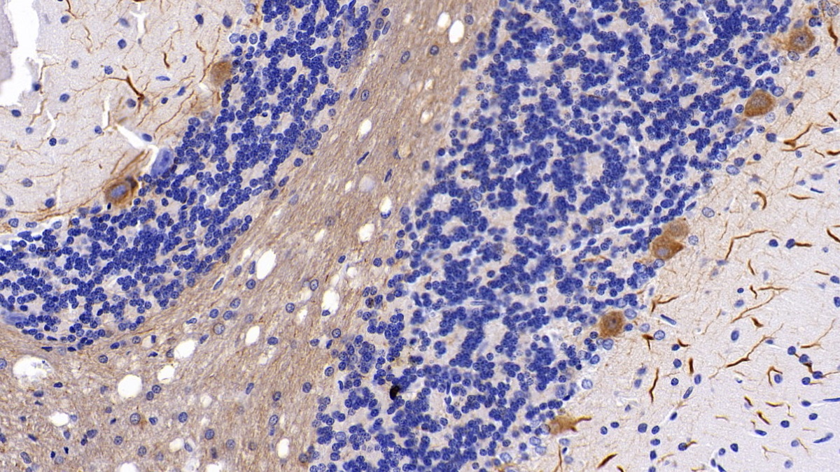 Polyclonal Antibody to Neurofilament, Light Polypeptide (NEFL)