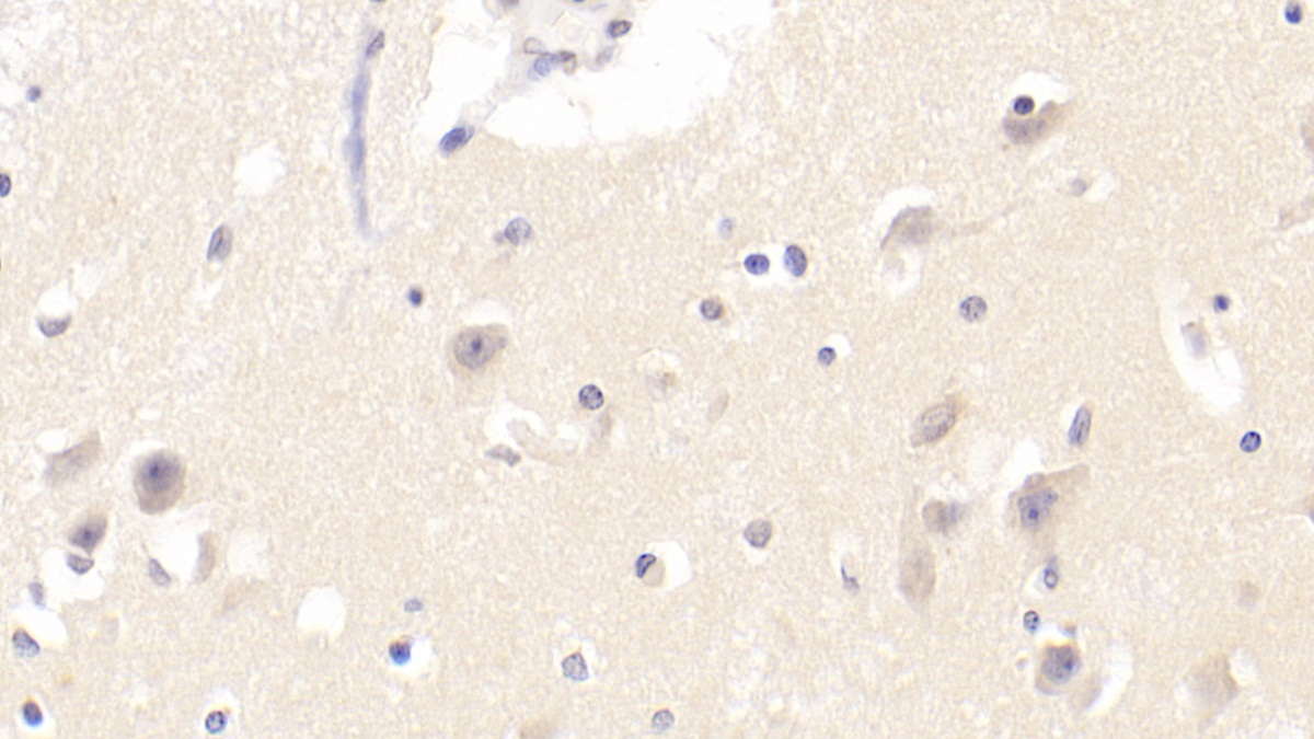 Polyclonal Antibody to Protocadherin Gamma A2 (PCDHgA2)