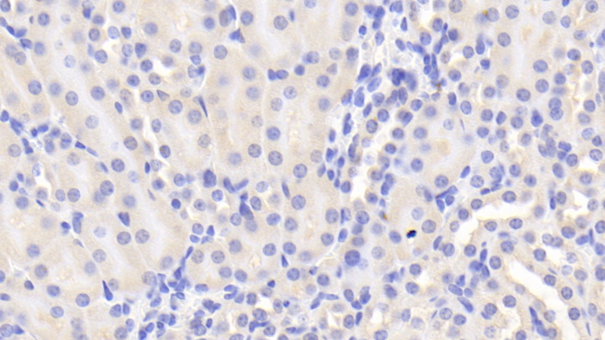 Polyclonal Antibody to Protocadherin 18 (PCDH18)