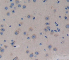 Polyclonal Antibody to Ephrin Type B Receptor 3 (EPHB3)