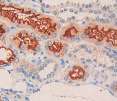 Polyclonal Antibody to Ephrin Type A Receptor 10 (EPHA10)