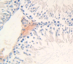 Polyclonal Antibody to Lipocalin 9 (LCN9)