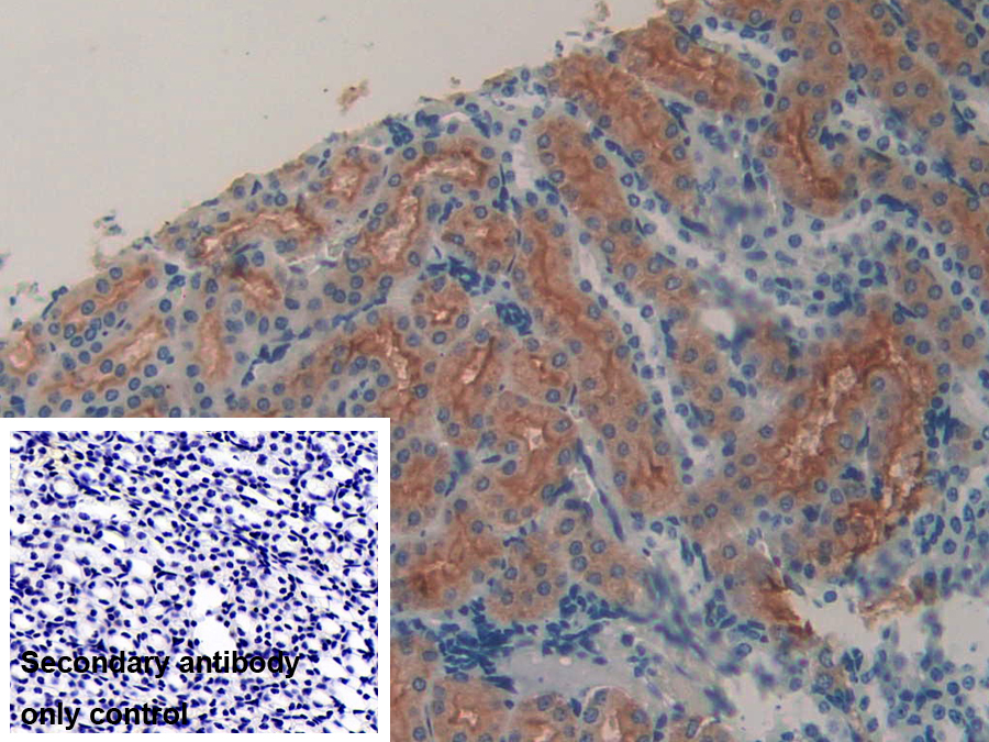 Polyclonal Antibody to Lipocalin 8 (LCN8)