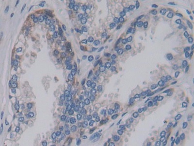 Polyclonal Antibody to Proprotein Convertase Subtilisin/Kexin Type 9 (PCSK9)