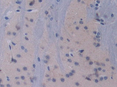 Polyclonal Antibody to Proprotein Convertase Subtilisin/Kexin Type 1 (PCSK1)